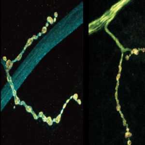 Individual neurons mix multiple RNA edits of key synapse protein via MIT News