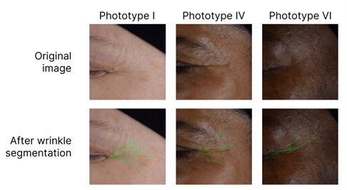 qima life sciences clinical evaluation of skin aging skinobs 2024