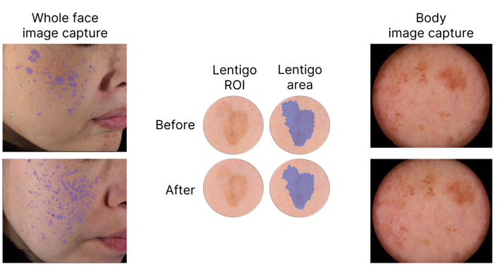 qima life sciences clinical evaluation of skin aging skinobs 2024