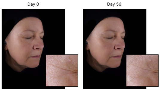 qima life sciences clinical evaluation of skin aging skinobs 2024