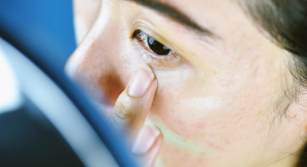The skin allergy risk assessment-integrated chemical environment (SARA-ICE) defined approach to derive points of departure for skin sensitization via Immunotoxicology