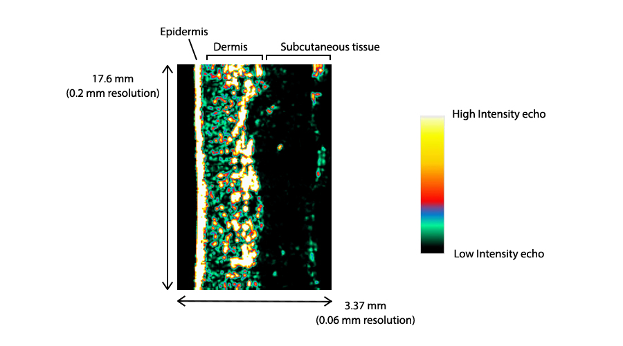 Get Deeper Insights with Ultrasound Imaging by Cortex Technology ...