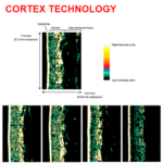 The DermaLab Combo 4 by Cortex – For Comprehensive Skin Analysis ...
