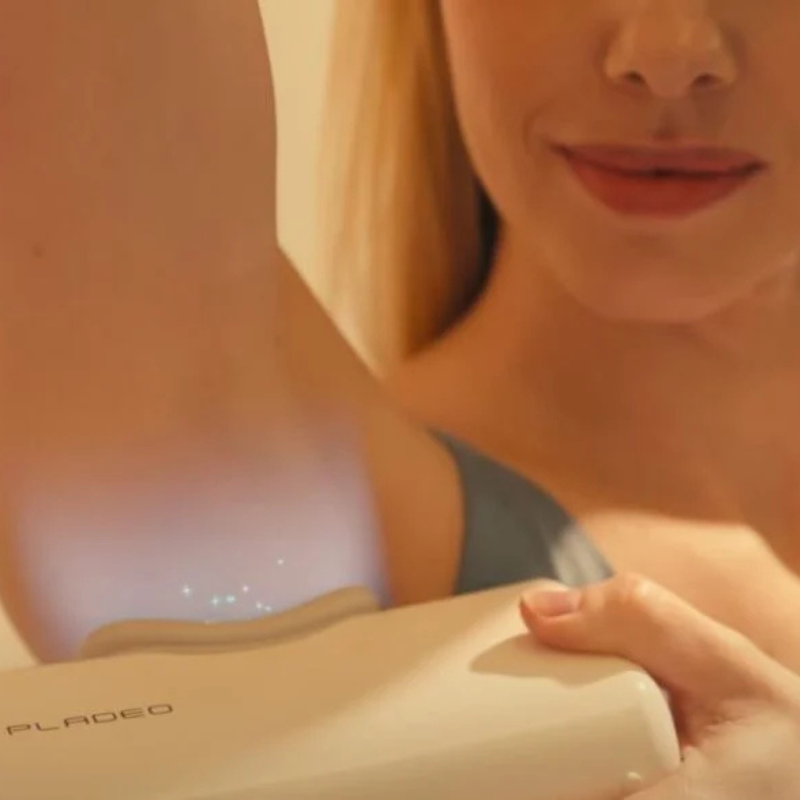 Épilation laser sur aisselle d'une femme souriante.