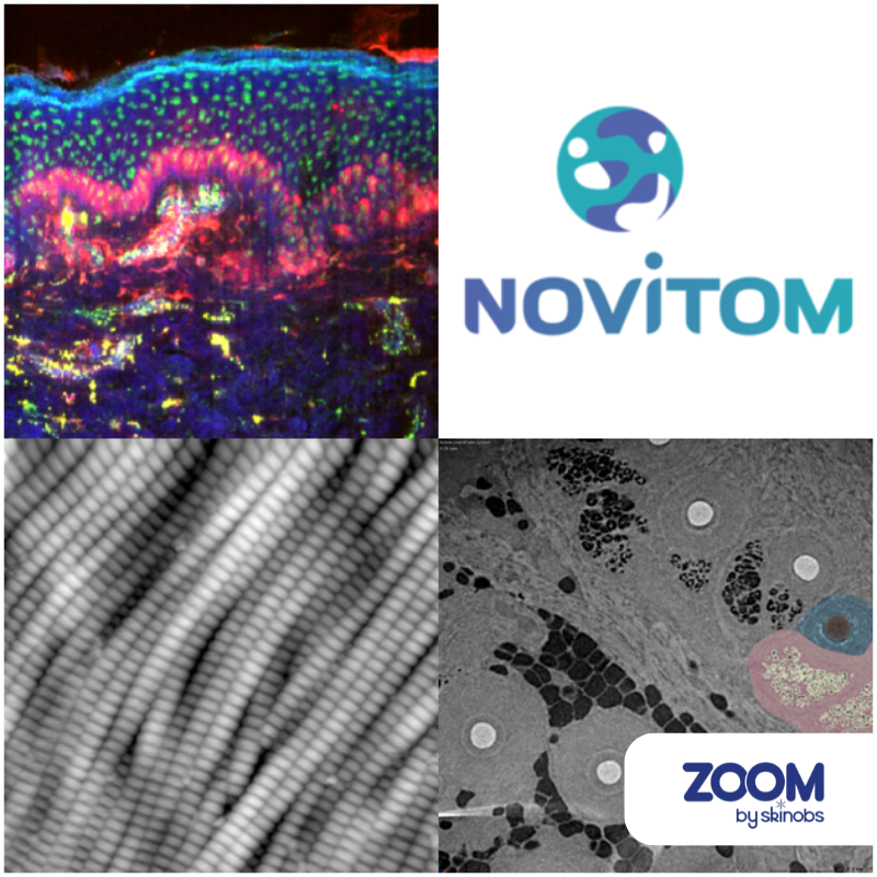 Images microscopiques et logos Novitom, Zoom by Skinobs.