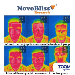 Évaluation thermographique infrarouge de groupes de traitement.