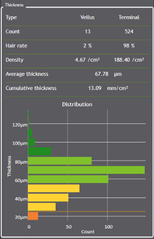 Graphique des épaisseurs de cheveux vellus et terminal.