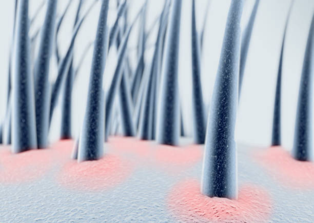 Représentation microscopique de cheveux sur cuir chevelu.